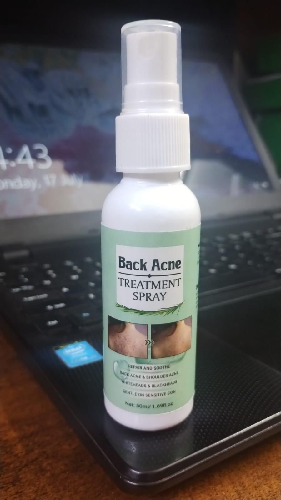 Back Acne Treatment Spray (Pack of 1) - AmazingBaba